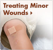 Treating Minor Wounds