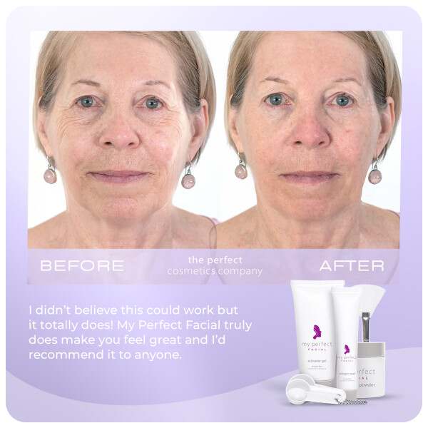 Buy My Perfect Facial 10 Treatments | Chemist Direct