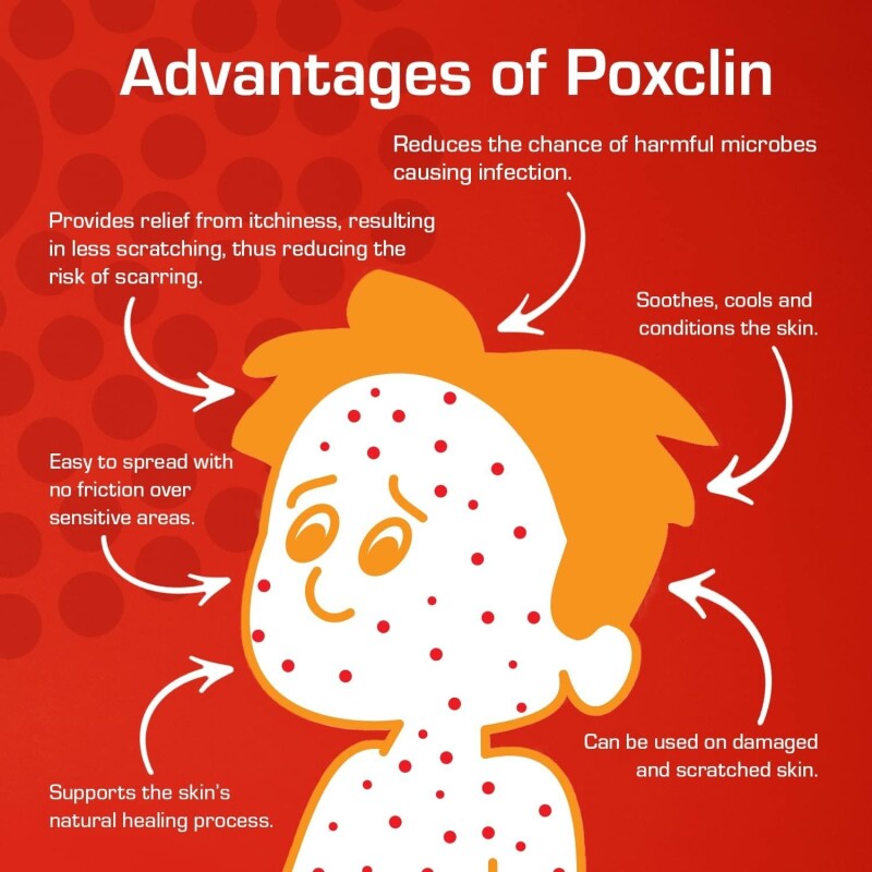 PoxClin Cool Mousse For Children With Chickenpox